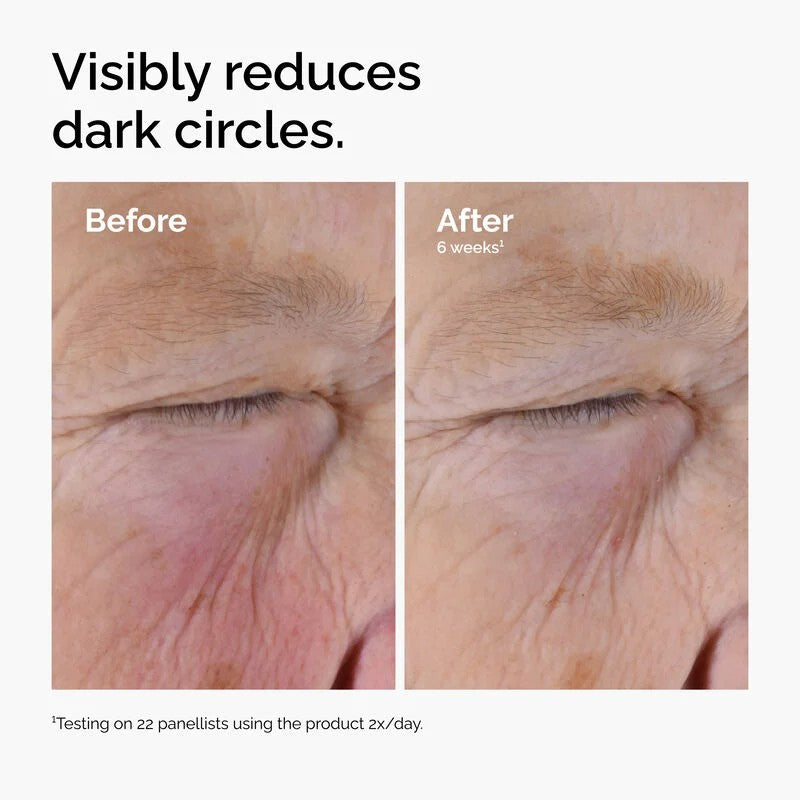 The Ordinary Solución de Cafeína 5% + EGCG, 30ml Sérum Deshinchante de Ojos para Ojeras y Ojos Cansados