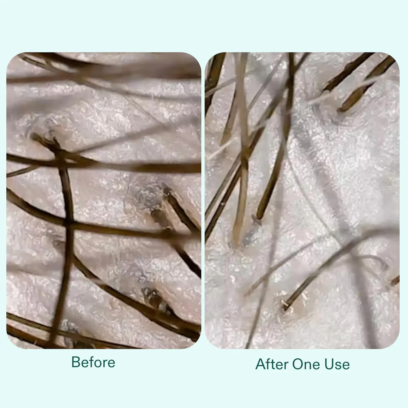 Champú Nutrafol Root Purifier para el cuero cabelludo con cabello debilitado 240ml